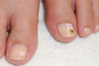nageldesign Blume